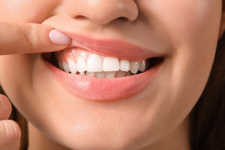 Cosmetic Dentistry