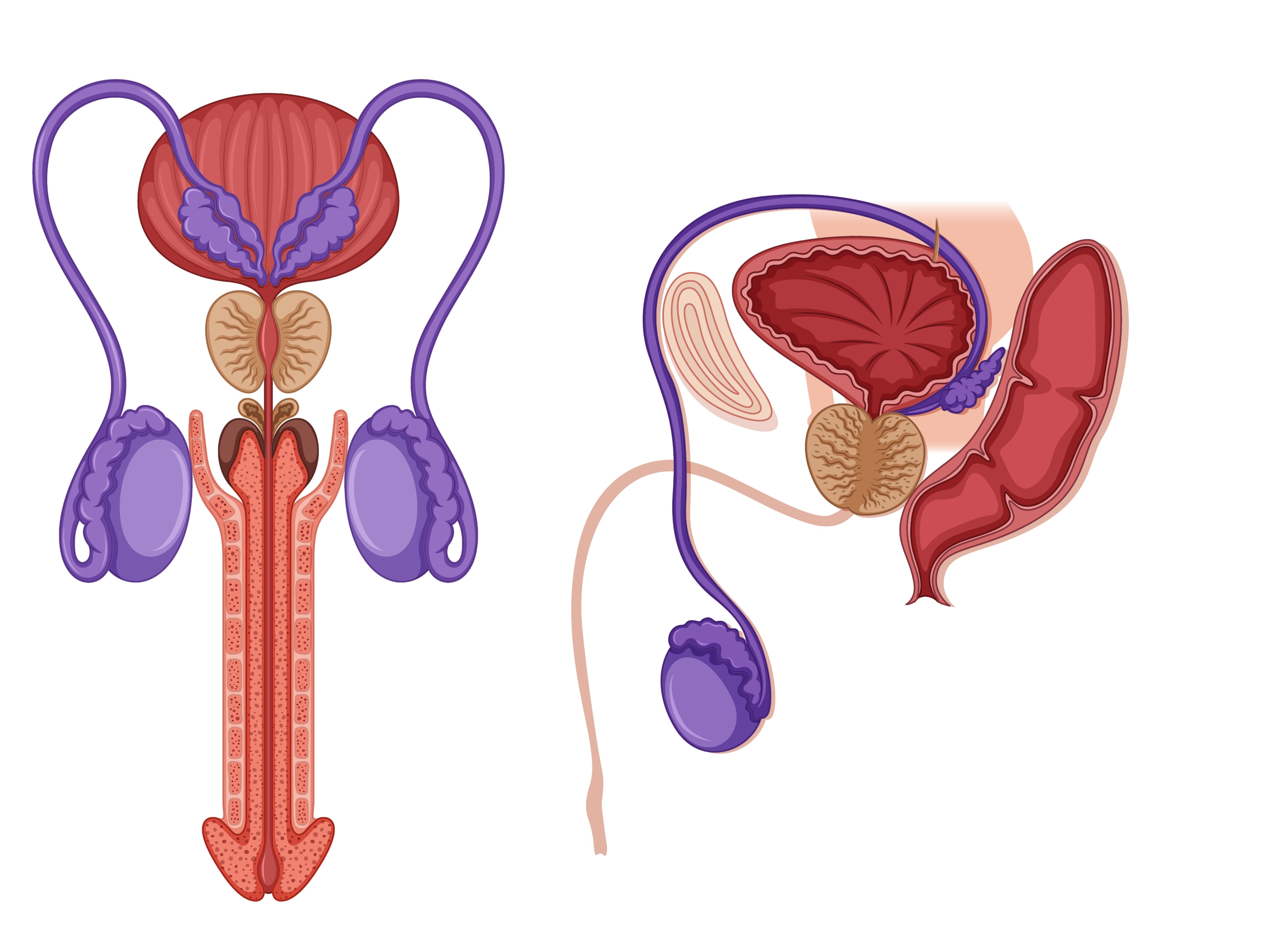 Varicocele embolization